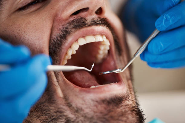Emergency Dental Services in Seattle, WA