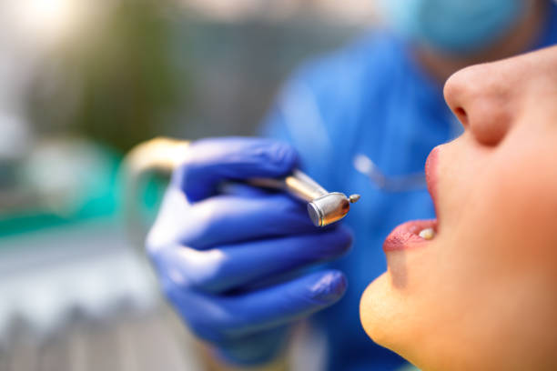 Dental Inlays and Onlays in Seattle, WA